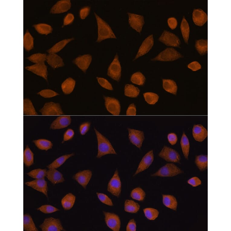 Immunofluorescence - Anti-Quinone oxidoreductase Antibody (A89553) - Antibodies.com