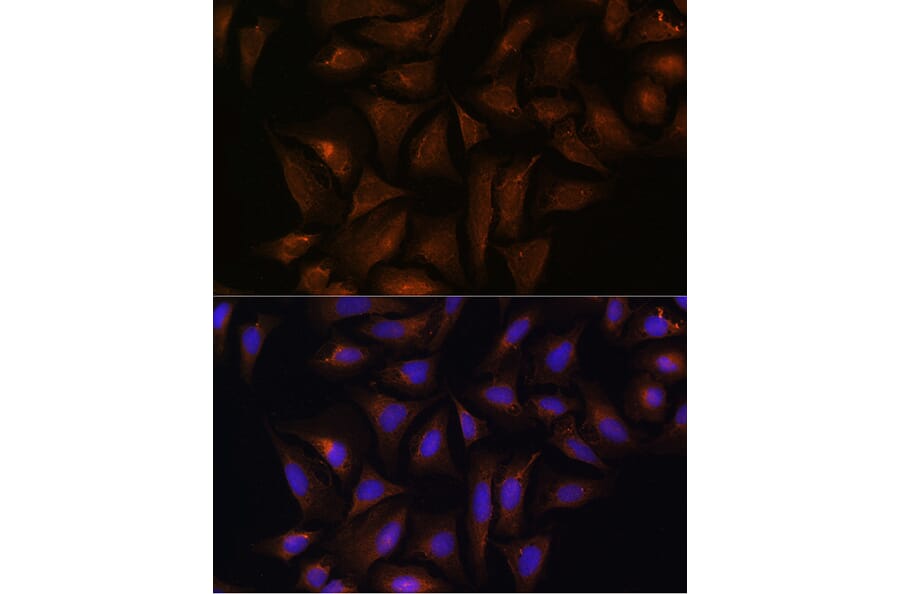 Immunofluorescence - Anti-Quinone oxidoreductase Antibody (A89553) - Antibodies.com