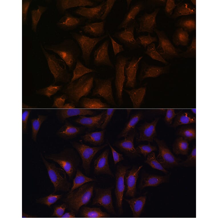 Immunofluorescence - Anti-Quinone oxidoreductase Antibody (A89553) - Antibodies.com