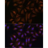 Immunofluorescence - Anti-Quinone oxidoreductase Antibody (A89553) - Antibodies.com