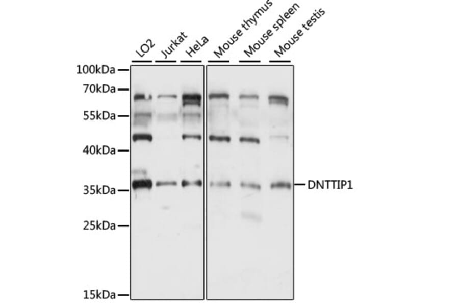 Western Blot - Anti-DNTTIP1/TDIF1 Antibody (A89554) - Antibodies.com