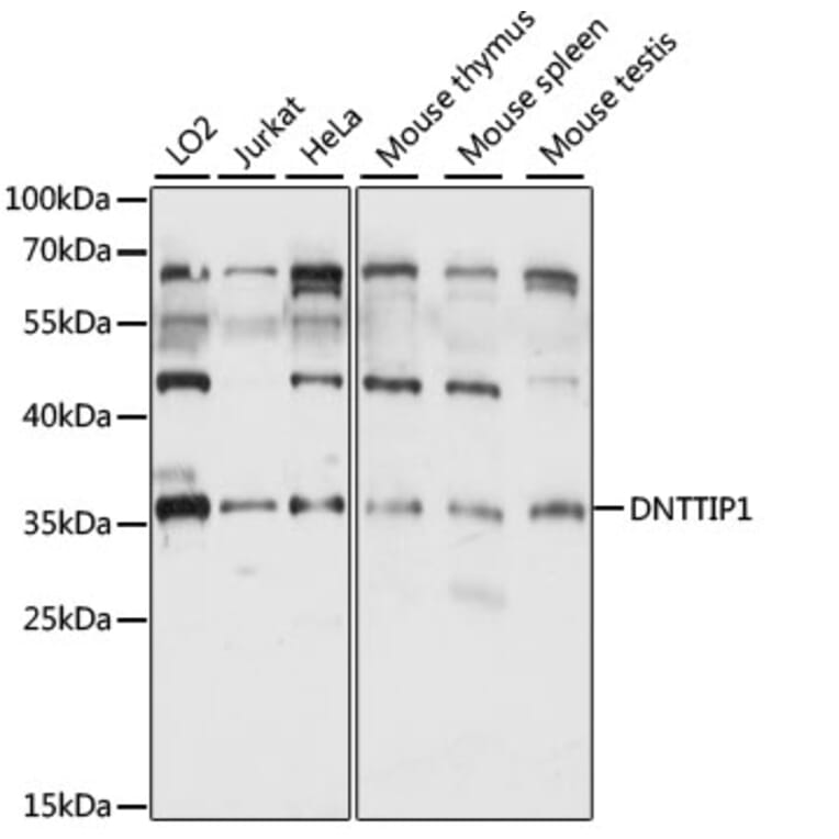 Western Blot - Anti-DNTTIP1/TDIF1 Antibody (A89554) - Antibodies.com