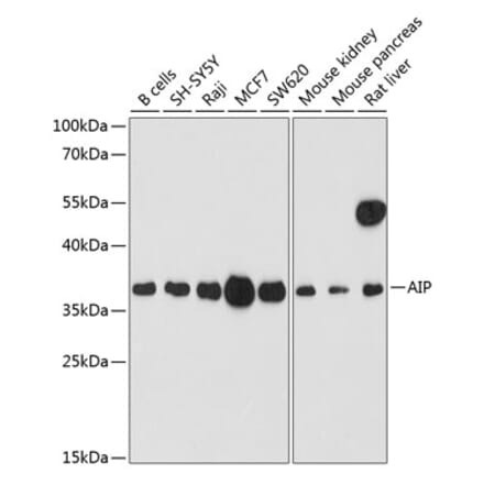Western Blot - Anti-AIP Antibody (A89555) - Antibodies.com
