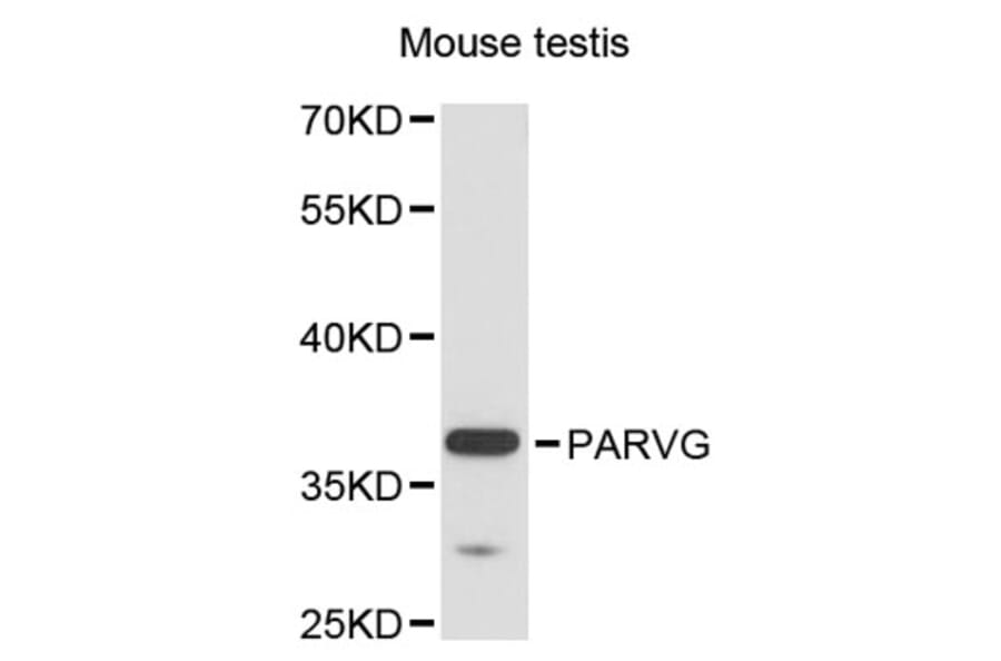 Western Blot - Anti-PARVG Antibody (A12876) - Antibodies.com