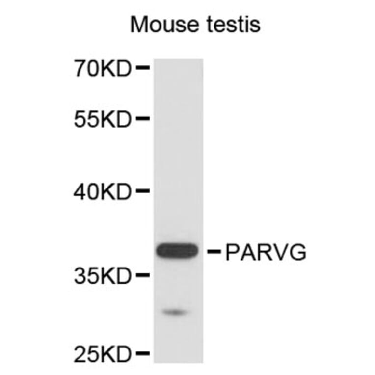 Western Blot - Anti-PARVG Antibody (A12876) - Antibodies.com