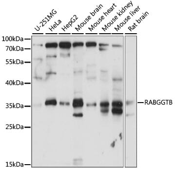 Western blot analysis of extracts of various cell lines, using Anti-RABGGTB Antibody (A15310) at 1:1,000 dilution.
Secondary antibody: Goat Anti-Rabbit IgG (H+L) (HRP) (AS014) at 1:10,000 dilution.
Lysates / proteins: 25µg per lane.
Blocking buffer: 3% non-fat dry milk in TBST.
Detection: ECL Basic Kit (RM00020).
Exposure time: 30s.
