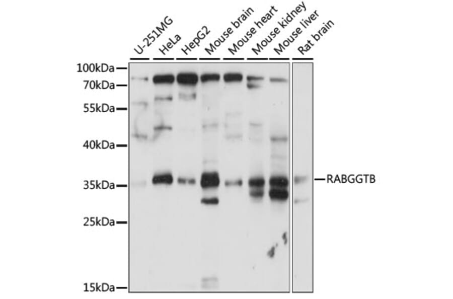 Western Blot - Anti-RABGGTB Antibody (A89557) - Antibodies.com