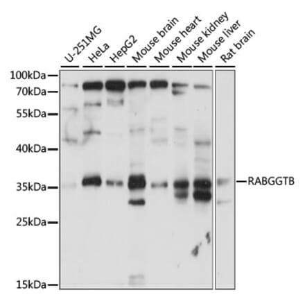 Western Blot - Anti-RABGGTB Antibody (A89557) - Antibodies.com