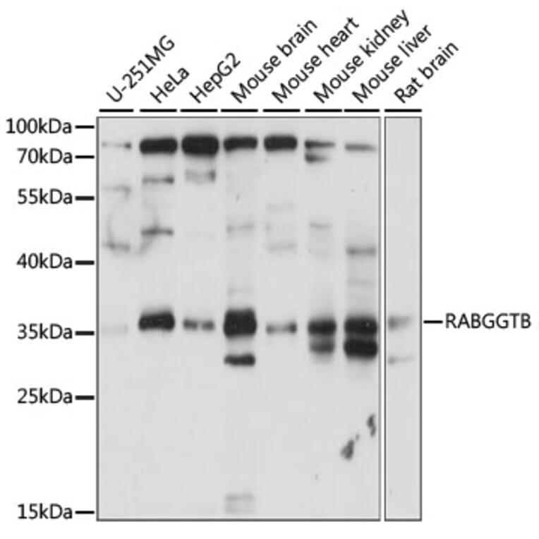 Western Blot - Anti-RABGGTB Antibody (A89557) - Antibodies.com