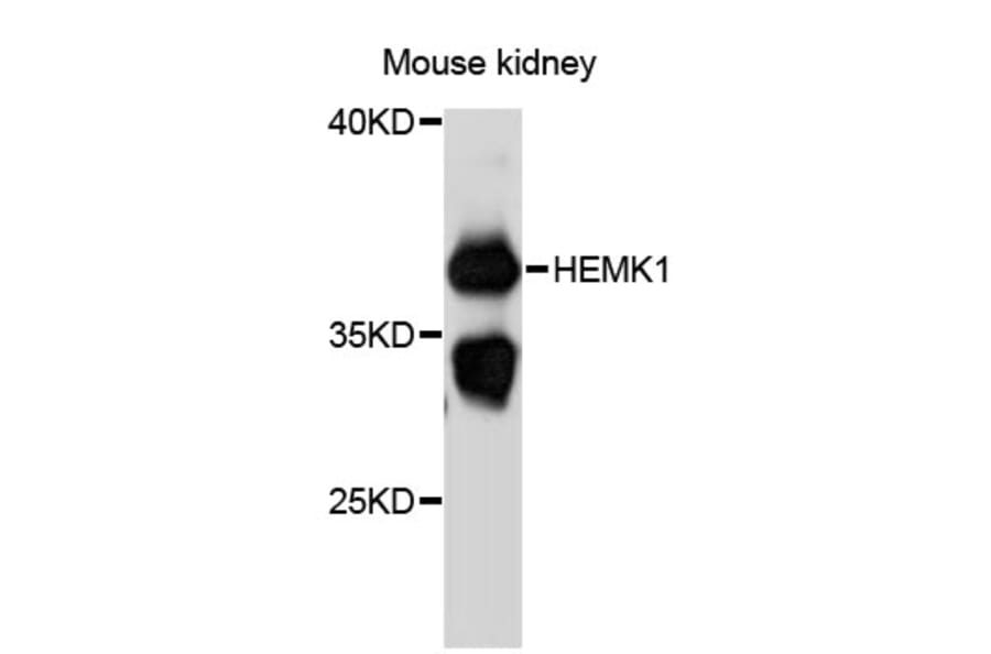 Western Blot - Anti-HEMK1 Antibody (A12651) - Antibodies.com
