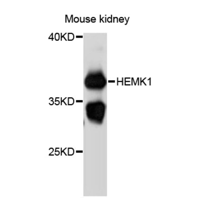 Western Blot - Anti-HEMK1 Antibody (A12651) - Antibodies.com