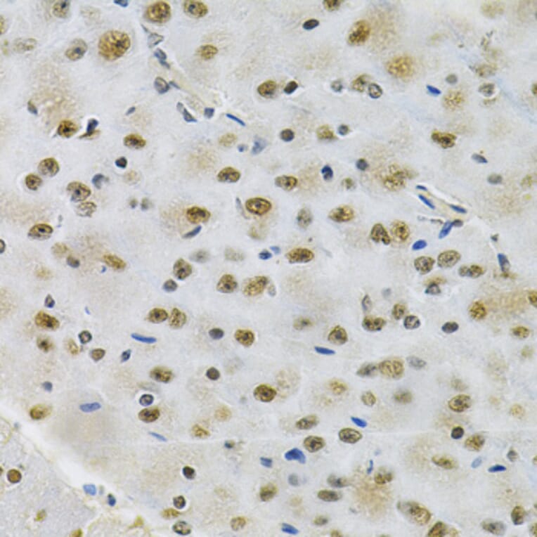 Immunohistochemistry - Anti-Otx2 Antibody (A89561) - Antibodies.com