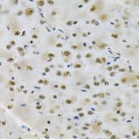 Immunohistochemistry - Anti-Otx2 Antibody (A89561) - Antibodies.com