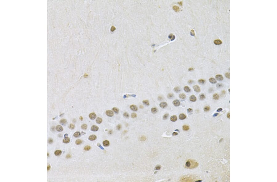 Immunohistochemistry - Anti-Otx2 Antibody (A89561) - Antibodies.com