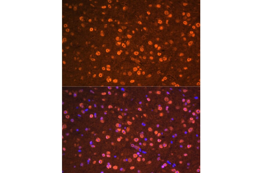 Immunofluorescence - Anti-Otx2 Antibody (A89561) - Antibodies.com
