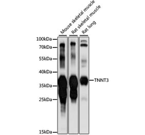 Western Blot - Anti-TNNT3 Antibody (A89562) - Antibodies.com