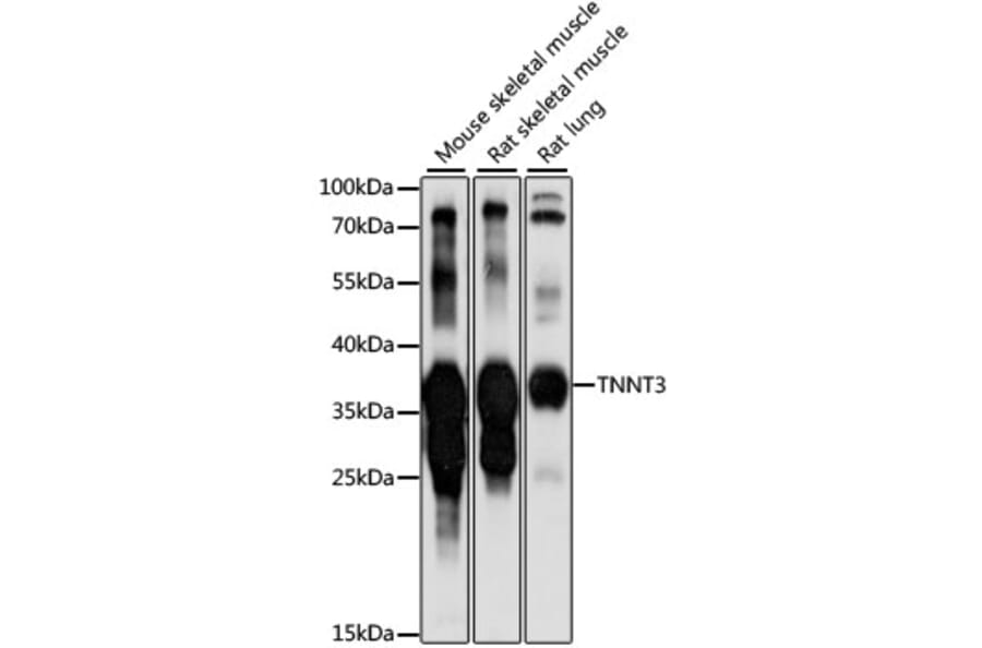 Western Blot - Anti-TNNT3 Antibody (A89562) - Antibodies.com