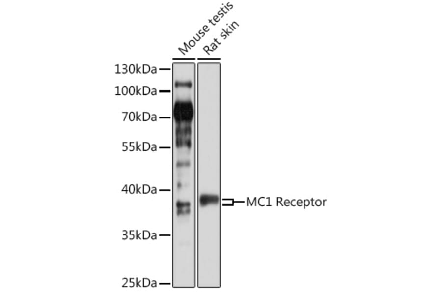 Western Blot - Anti-MC1-R Antibody (A89563) - Antibodies.com