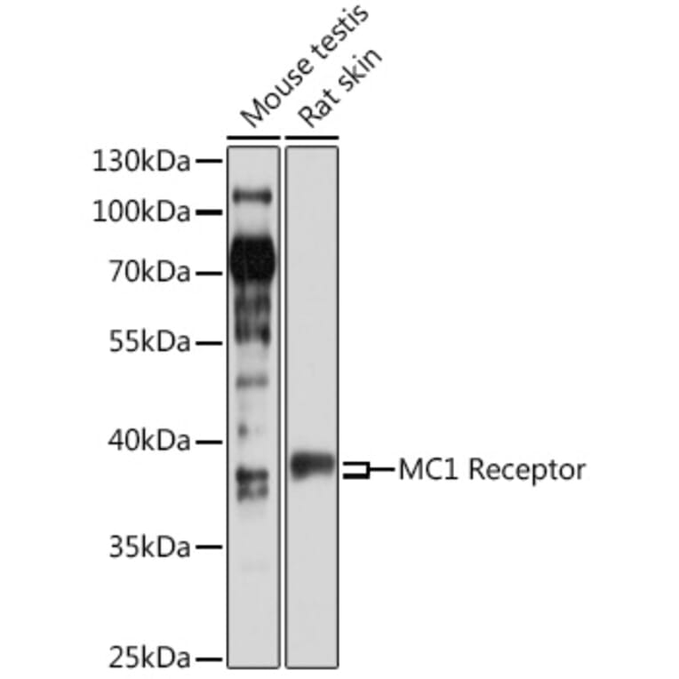 Western Blot - Anti-MC1-R Antibody (A89563) - Antibodies.com