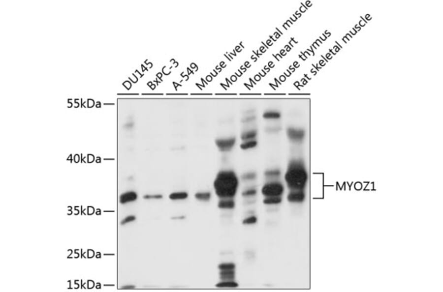Western Blot - Anti-Myozenin 1 Antibody (A89564) - Antibodies.com