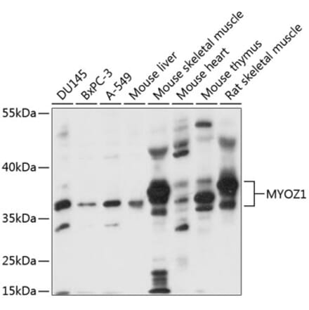 Western Blot - Anti-Myozenin 1 Antibody (A89564) - Antibodies.com