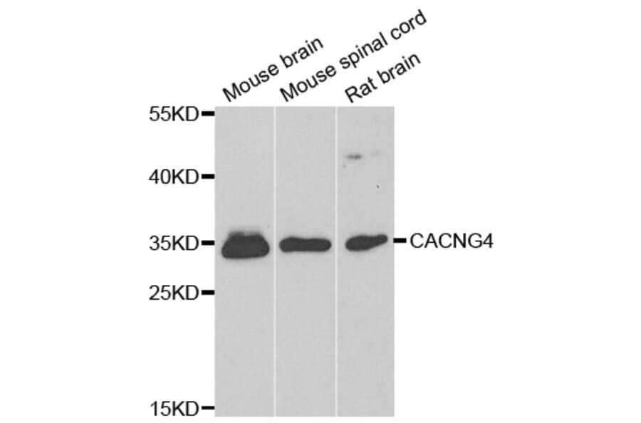 Western Blot - Anti-CACNG4 Antibody (A14118) - Antibodies.com