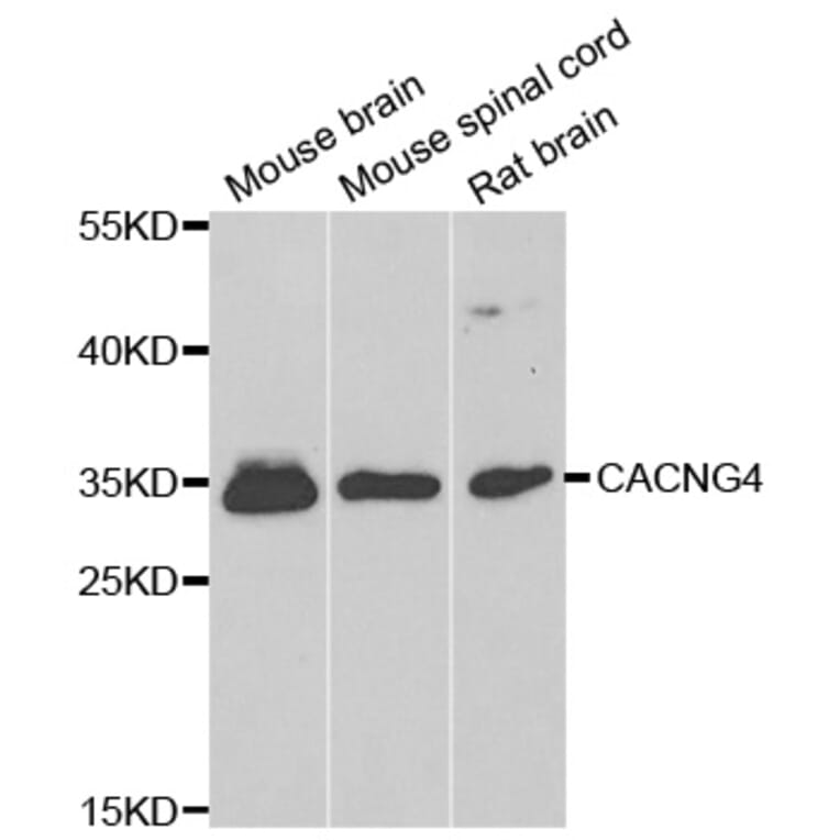 Western Blot - Anti-CACNG4 Antibody (A14118) - Antibodies.com