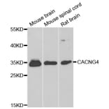Western Blot - Anti-CACNG4 Antibody (A14118) - Antibodies.com