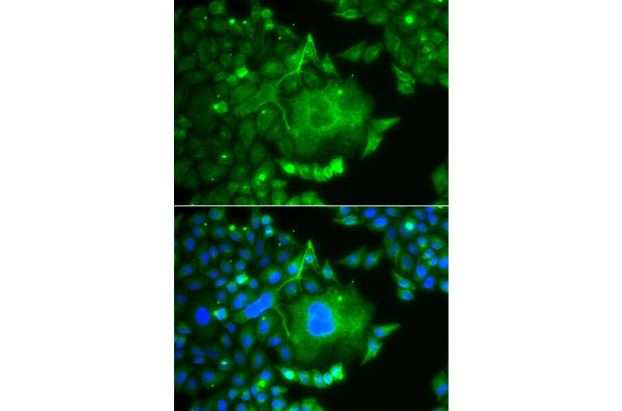 Immunofluorescence - Anti-CACNG4 Antibody (A14118) - Antibodies.com