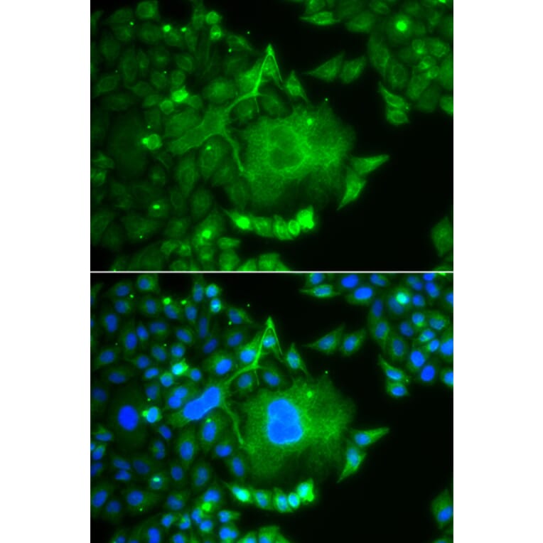 Immunofluorescence - Anti-CACNG4 Antibody (A14118) - Antibodies.com