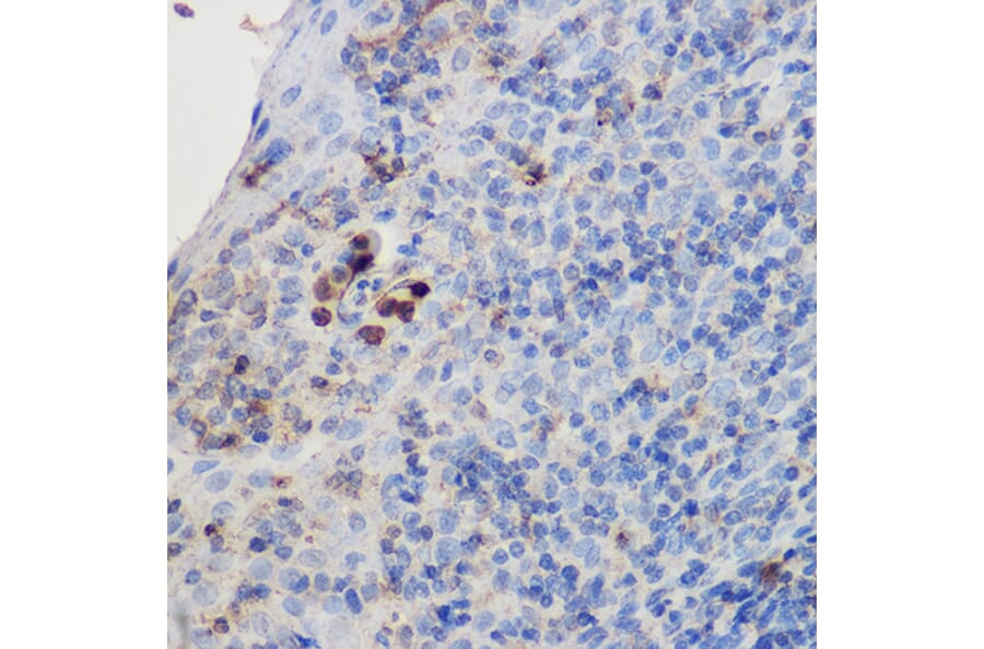 Immunohistochemistry - Anti-IL-17A Antibody (A89567) - Antibodies.com