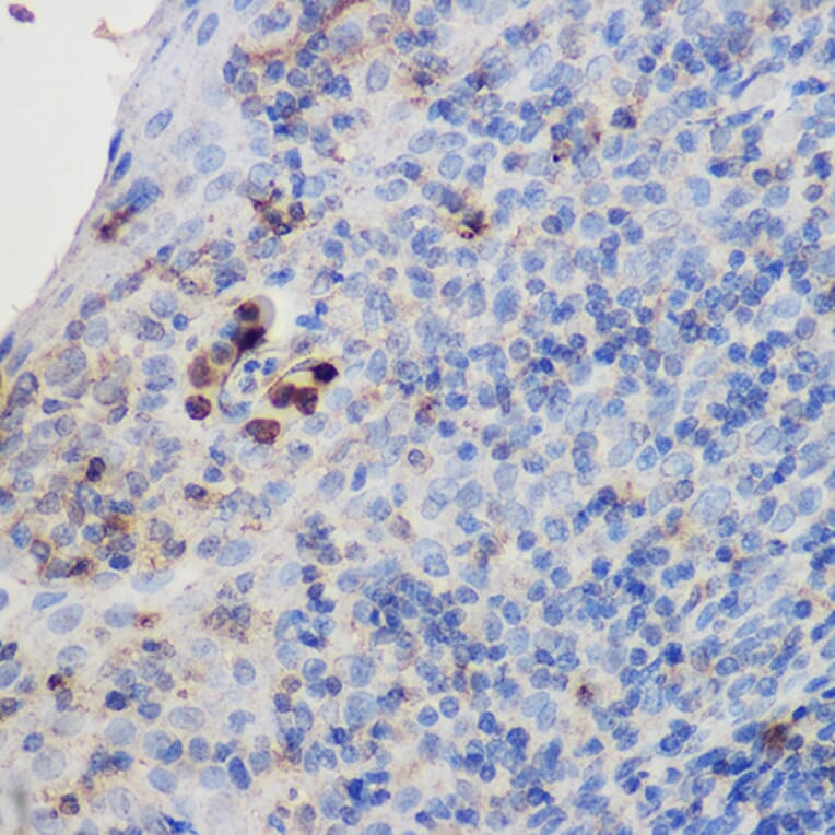 Immunohistochemistry - Anti-IL-17A Antibody (A89567) - Antibodies.com