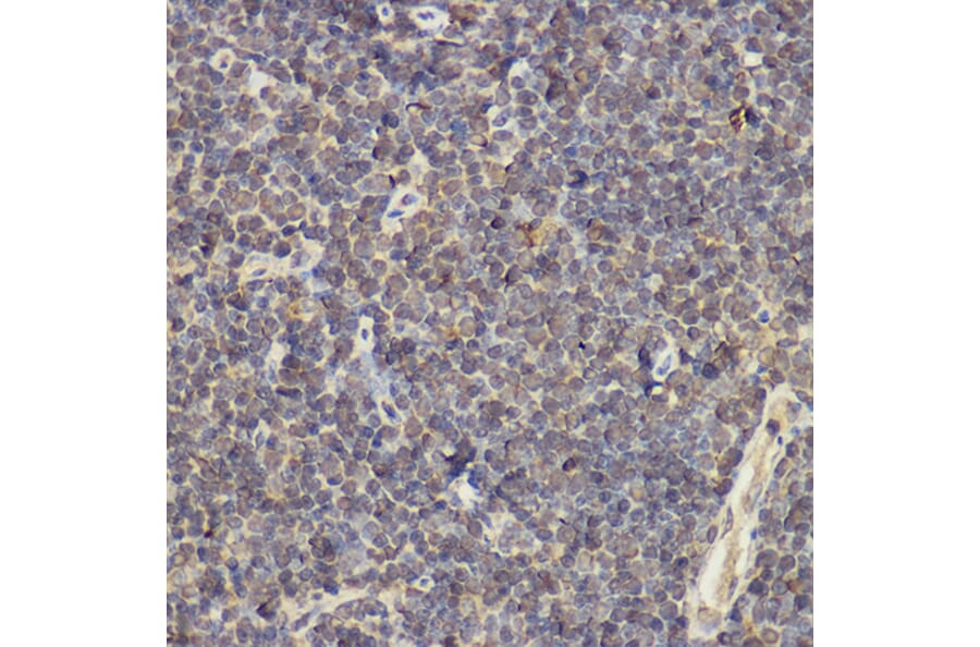 Immunohistochemistry - Anti-IL-17A Antibody (A89567) - Antibodies.com