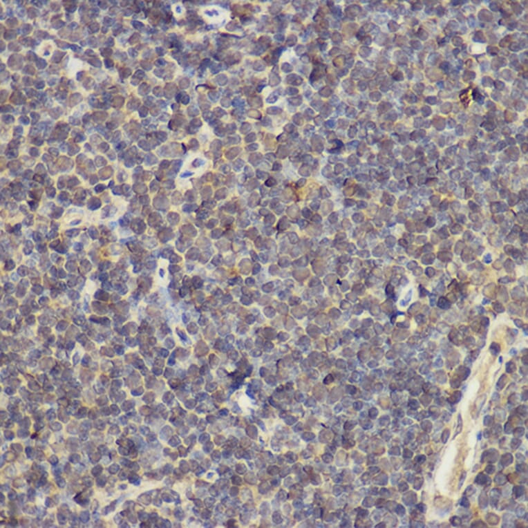 Immunohistochemistry - Anti-IL-17A Antibody (A89567) - Antibodies.com