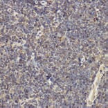 Immunohistochemistry - Anti-IL-17A Antibody (A89567) - Antibodies.com