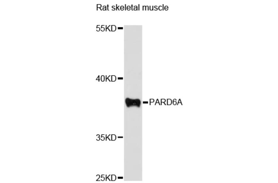 Western Blot - Anti-PARD6A Antibody (A12755) - Antibodies.com