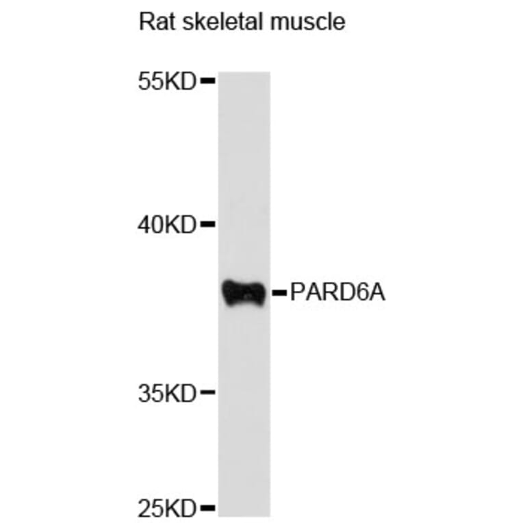 Western Blot - Anti-PARD6A Antibody (A12755) - Antibodies.com