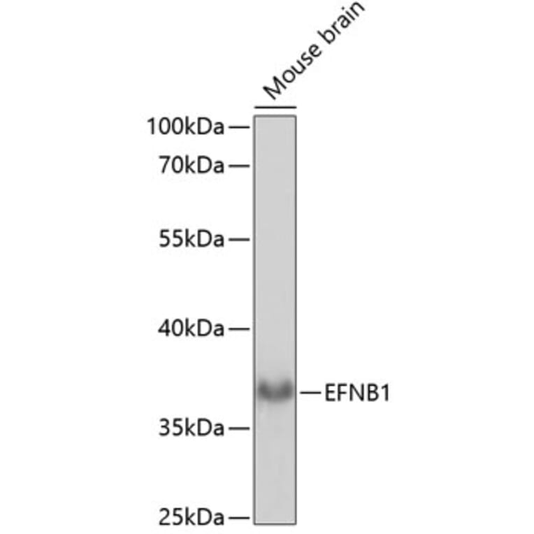 Western Blot - Anti-Ephrin B1 Antibody (A89569) - Antibodies.com