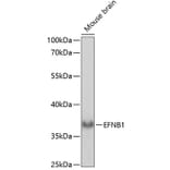 Western Blot - Anti-Ephrin B1 Antibody (A89569) - Antibodies.com