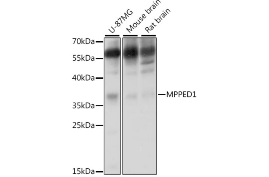 Western Blot - Anti-MPPED1 Antibody (A15652) - Antibodies.com
