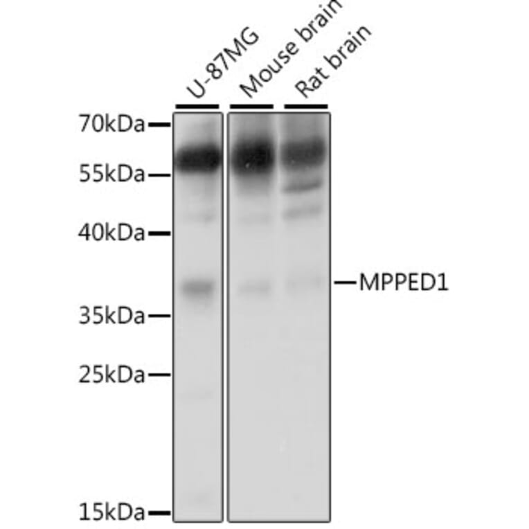 Western Blot - Anti-MPPED1 Antibody (A15652) - Antibodies.com