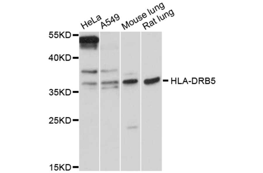 Western Blot - Anti-HLA-DRB5 Antibody (A12726) - Antibodies.com