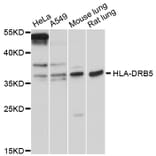Western Blot - Anti-HLA-DRB5 Antibody (A12726) - Antibodies.com