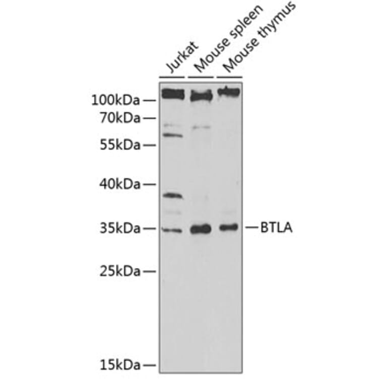 Western Blot - Anti-CD272/BTLA Antibody (A89572) - Antibodies.com