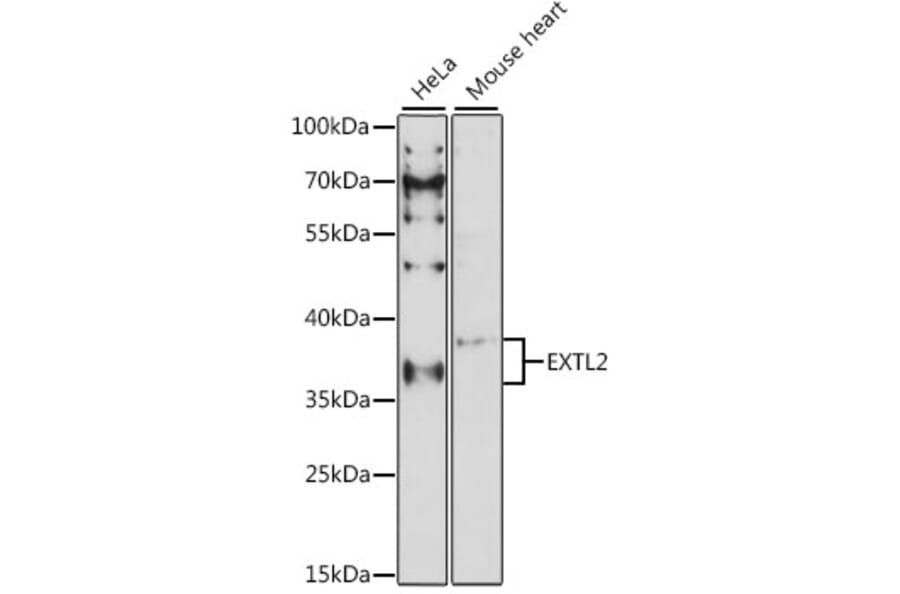 Western Blot - Anti-EXTL2 Antibody (A89573) - Antibodies.com