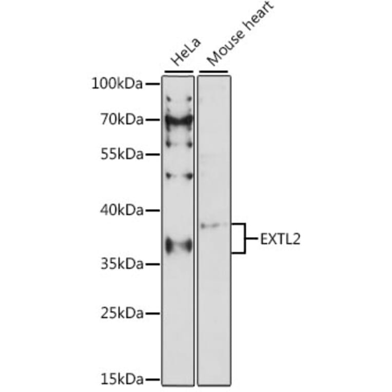 Western Blot - Anti-EXTL2 Antibody (A89573) - Antibodies.com