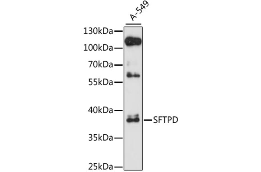 Western Blot - Anti-SFTPD Antibody (A1651) - Antibodies.com