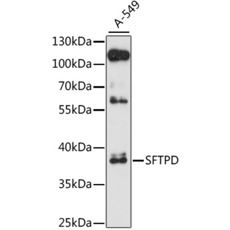 Western Blot - Anti-SFTPD Antibody (A1651) - Antibodies.com