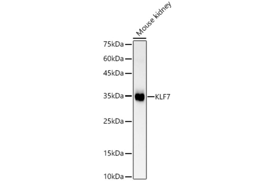 Western Blot - Anti-KLF7 Antibody (A89575) - Antibodies.com