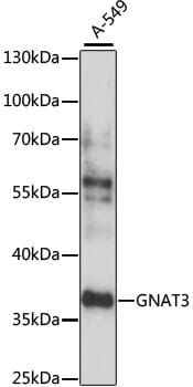 Western blot analysis of extracts of A-549 cells, using Anti-GNAT3 Antibody (A15982) at 1:1,000 dilution.
Secondary antibody: Goat Anti-Rabbit IgG (H+L) (HRP) (AS014) at 1:10,000 dilution.
Lysates / proteins: 25µg per lane.
Blocking buffer: 3% non-fat dry milk in TBST.
Detection: ECL Basic Kit (RM00020).
Exposure time: 1s.